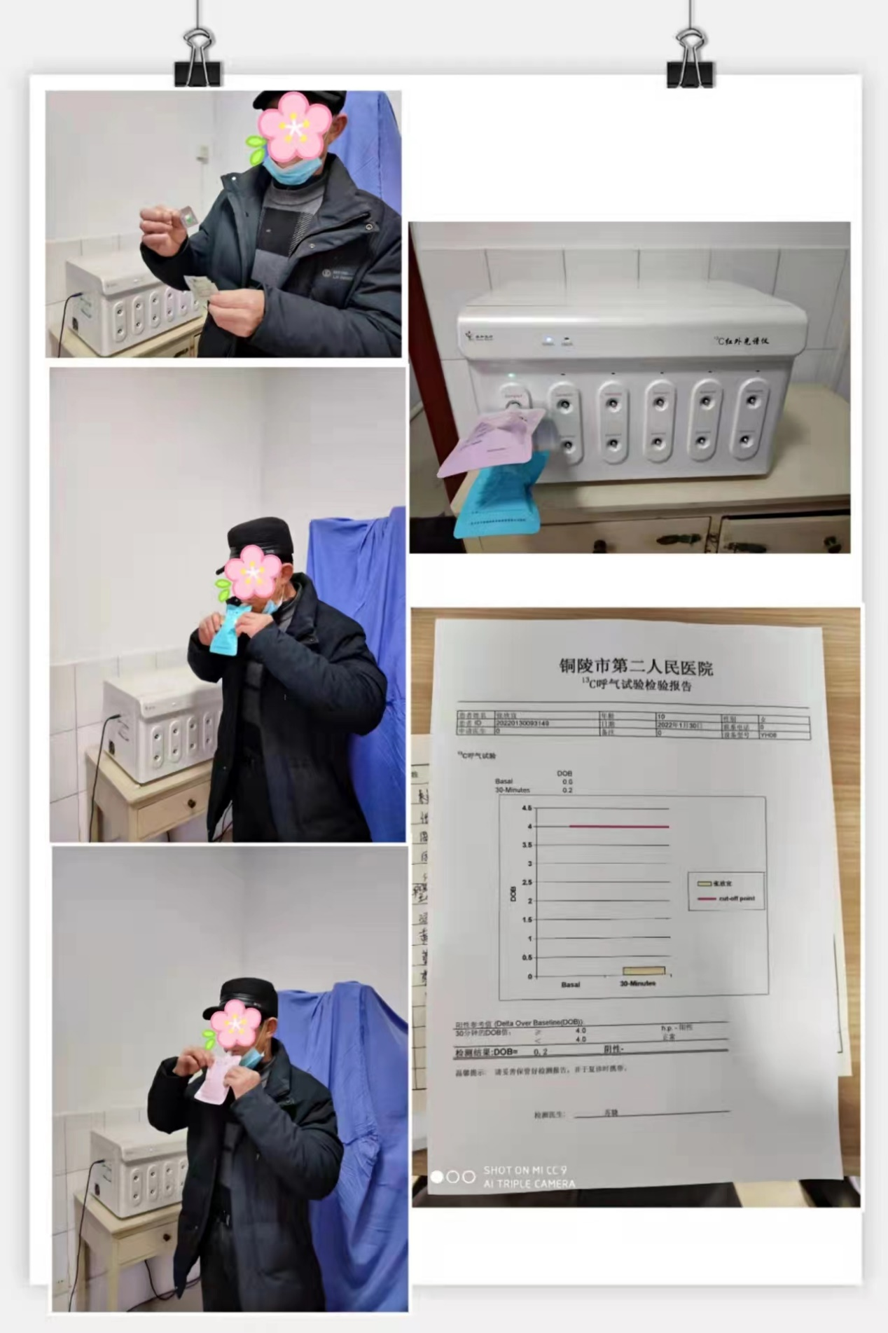 碳13-尿素呼氣試驗.png